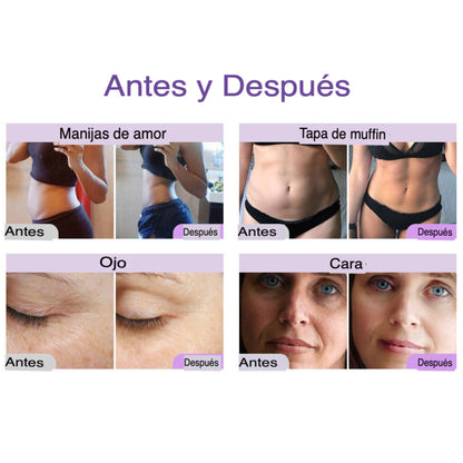 Multifuncional 9 en 1 Pro 2.5  para Spa y Estética Cavitación 40K, Radiofrecuencia, Succión al Vacío, Fototerapia LED, Láser Lipolítico y Rejuvenecimiento Facial , Remodelación Corporal, Reafirmación de la Piel, Eliminación de Celulitis, Drenaje linfático