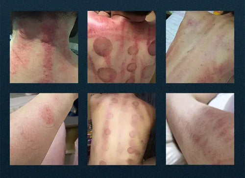 Radiofrecuencia 9 en 1 Facial y Corporal con Cavitación 80K — GSCOM