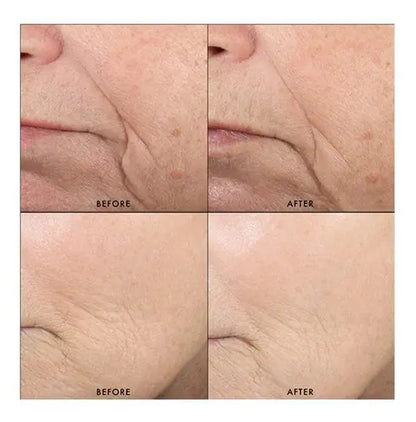 SkinCeuticals Triple Lipid Restore 2:4:2 48ml