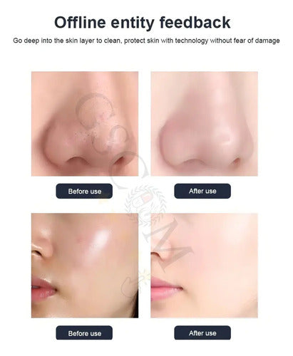 Equipo Hydrafacial Profesional 10 en 1 — Hidrodermoabrasión