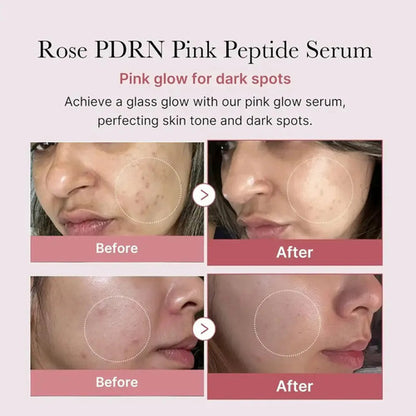 Serum Medicube Pdrn Pink Niacinamida Corea Premium Pro 30ml