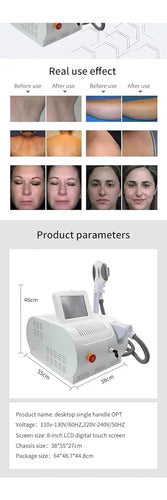 Equipo IPL OPT Profesional — Fotodepilación y Fotorrejuvenecimiento