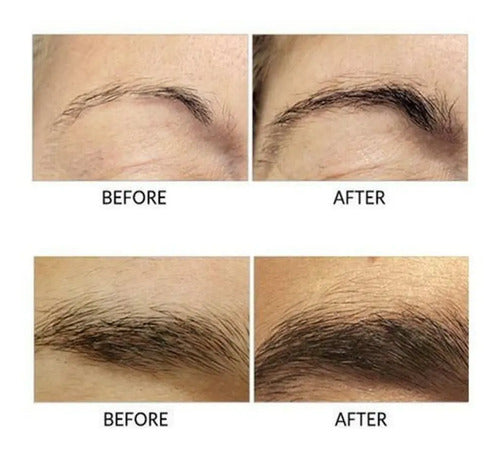 RapidBrow Eyebrow Enhancing Serum - 0.1 fl oz