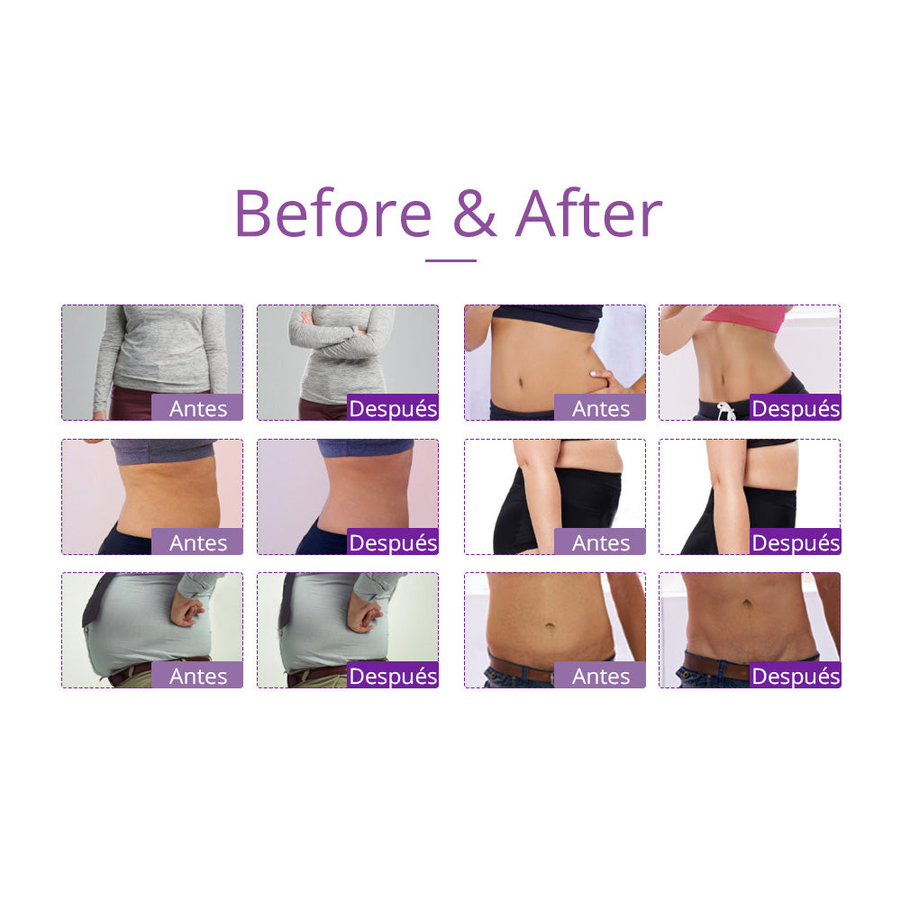 Equipo Multifuncional Radiofrecuencia 9 Funciones en 1 con Cavitación 2.0 Avanzada de 40K , Martillo, Vacum, Lipolaser 8 manerales Robustos