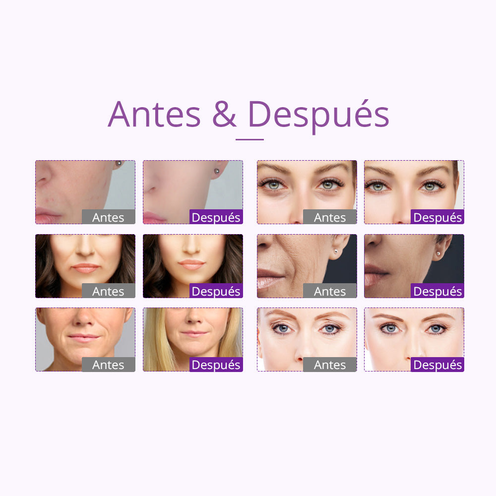 Equipo Multifuncional Radiofrecuencia 9 Funciones en 1 con Cavitación 2.0 Avanzada de 40K , Martillo, Vacum, Lipolaser 8 manerales Robustos