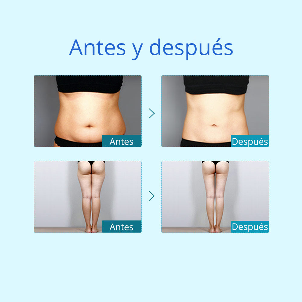 Criolipólisis Profesional 2 Cabezales – Reducción de Grasa, Modelado y Definición Corporal