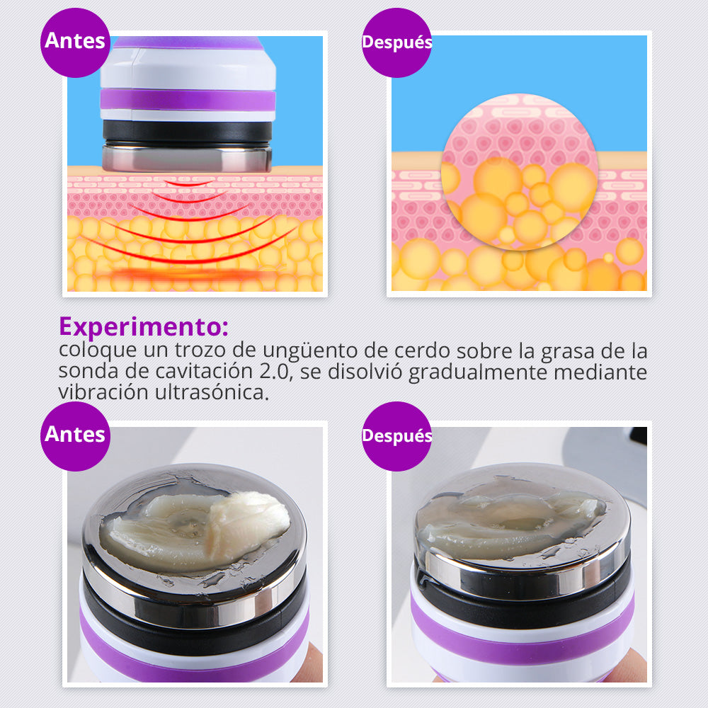 Multifunciona Portátil de 5 en 1 con Cavitación  2.5 de 40K, Radiofrecuencia Facial y Corporal, Vacuum RF, LED y Terapia de Succión para SPA en Casa o Cabina