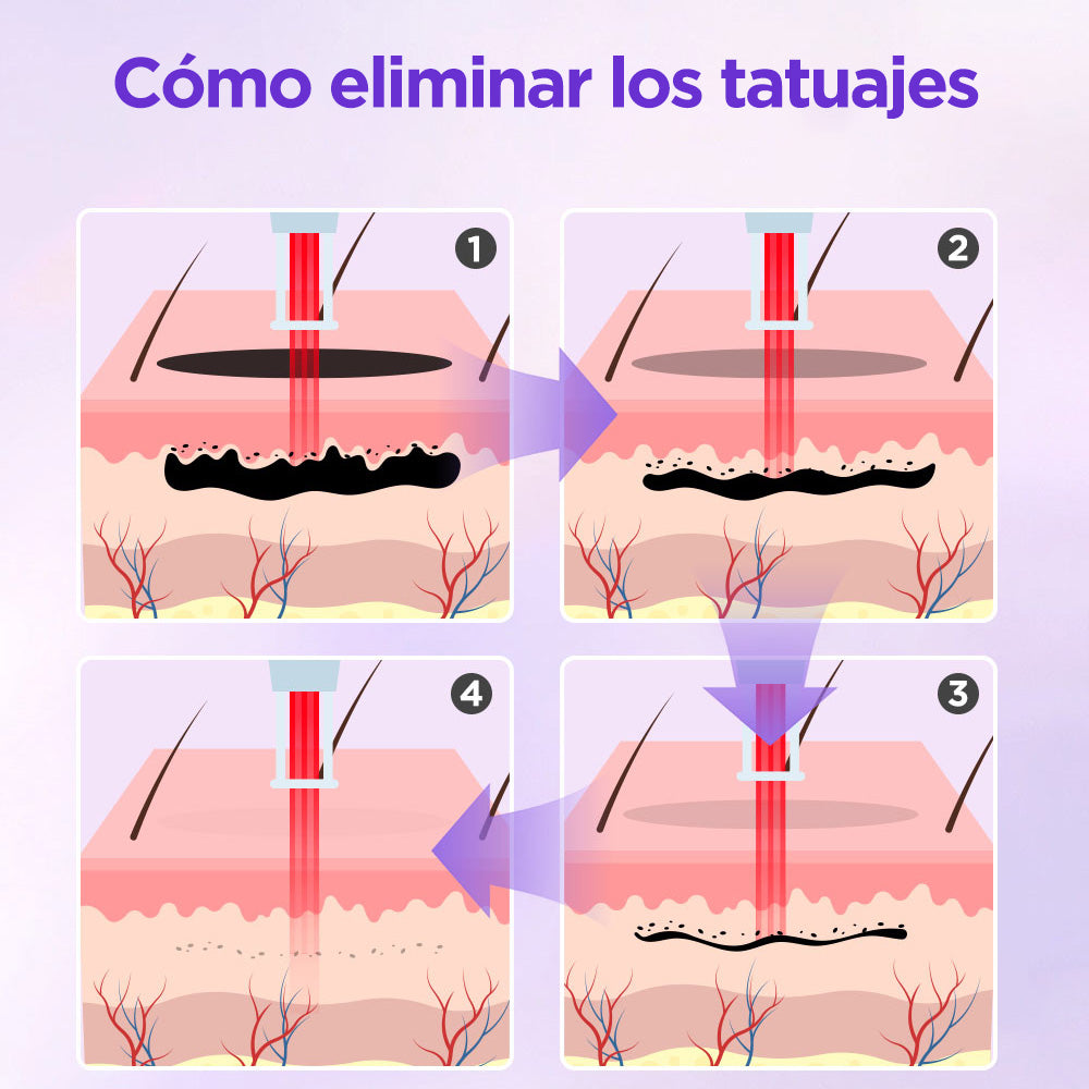 Equipo Láser Profesional HR-AS23 para Depilación Definitiva, Rejuvenecimiento Facial, Eliminación de Arrugas, Acné, Manchas, Tatuajes y Vello no Deseado