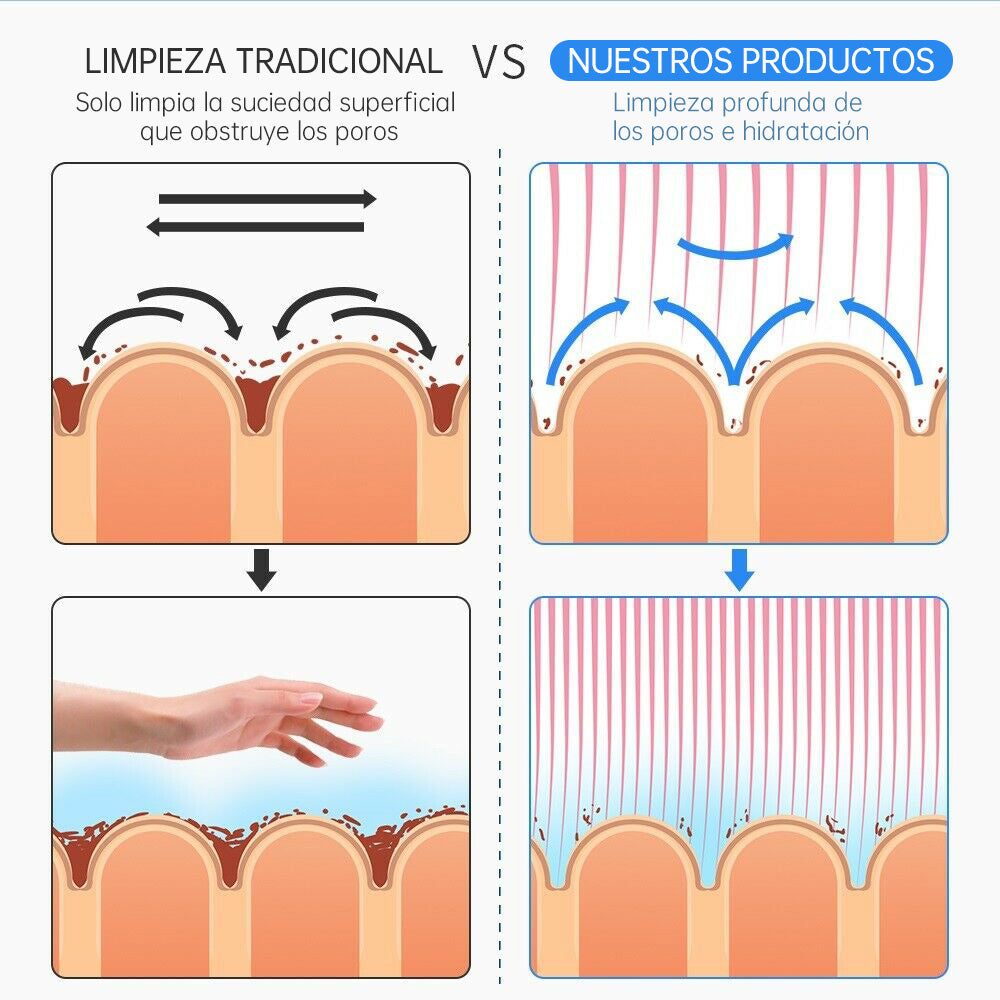 Máquina Hidrofacial 6 en 1  Limpieza Profunda, Microdermoabrasión, Radiofrecuencia, Ultrasonido, Pulverizador, Terapia Fría – Profesional para Spa y Estética
