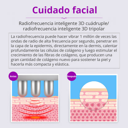 Multifunciona Portátil de 5 en 1 con Cavitación  2.5 de 40K, Radiofrecuencia Facial y Corporal, Vacuum RF, LED y Terapia de Succión para SPA en Casa o Cabina