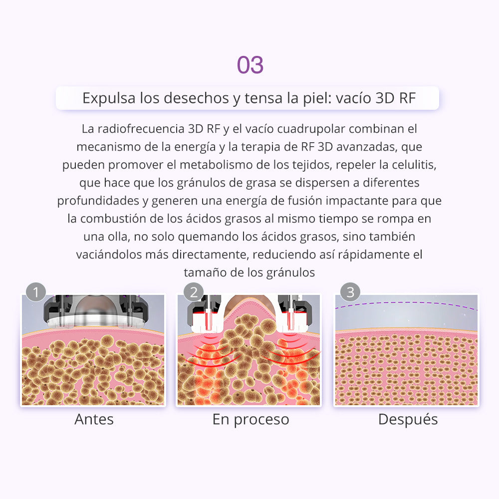 Equipo Multifuncional Radiofrecuencia 9 Funciones en 1 con Cavitación 2.0 Avanzada de 40K , Martillo, Vacum, Lipolaser 8 manerales Robustos
