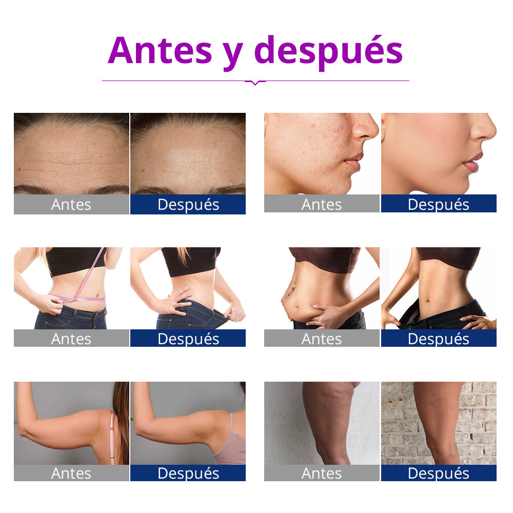 Multifunciona Portátil de 5 en 1 con Cavitación  2.5 de 40K, Radiofrecuencia Facial y Corporal, Vacuum RF, LED y Terapia de Succión para SPA en Casa o Cabina