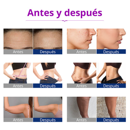 Multifunciona Portátil de 5 en 1 con Cavitación  2.5 de 40K, Radiofrecuencia Facial y Corporal, Vacuum RF, LED y Terapia de Succión para SPA en Casa o Cabina
