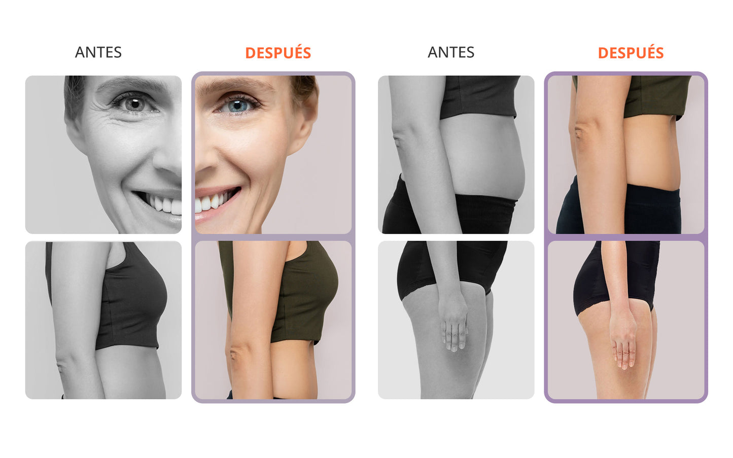 Radiofrecuencia 4 en 1 Cavitación 30K Ultra Pro, Vacuum, EMS y Electroporador Facial-Corporal