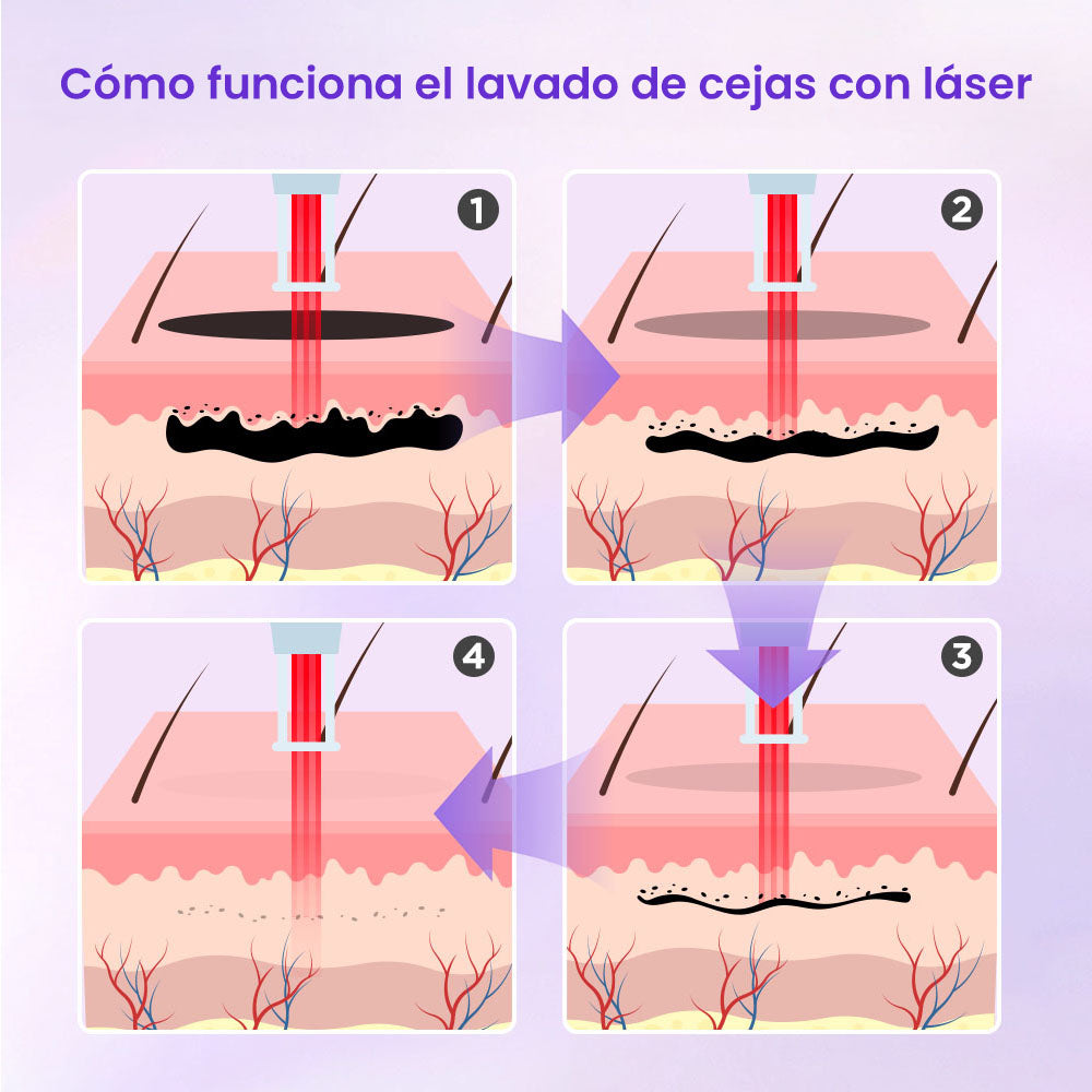 Professional 2-in-1 Equipment for Permanent Hair Removal, Whitening, Facial Rejuvenation, Tattoo Removal, Spots, Moles and Acne