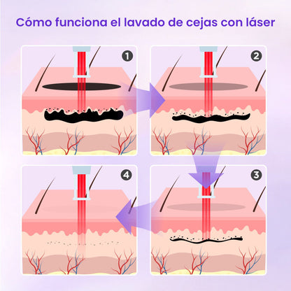 Professional 2-in-1 Equipment for Permanent Hair Removal, Whitening, Facial Rejuvenation, Tattoo Removal, Spots, Moles and Acne